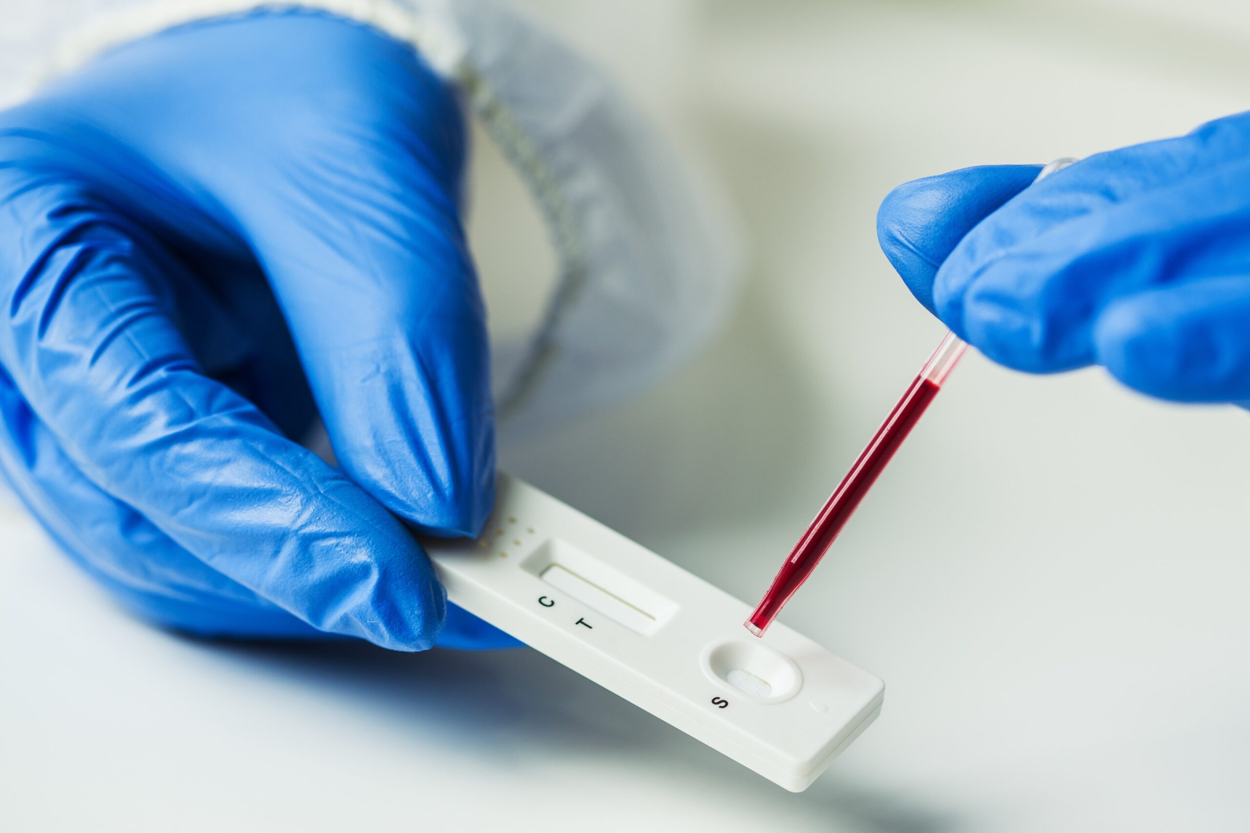 Coronavirus serological test