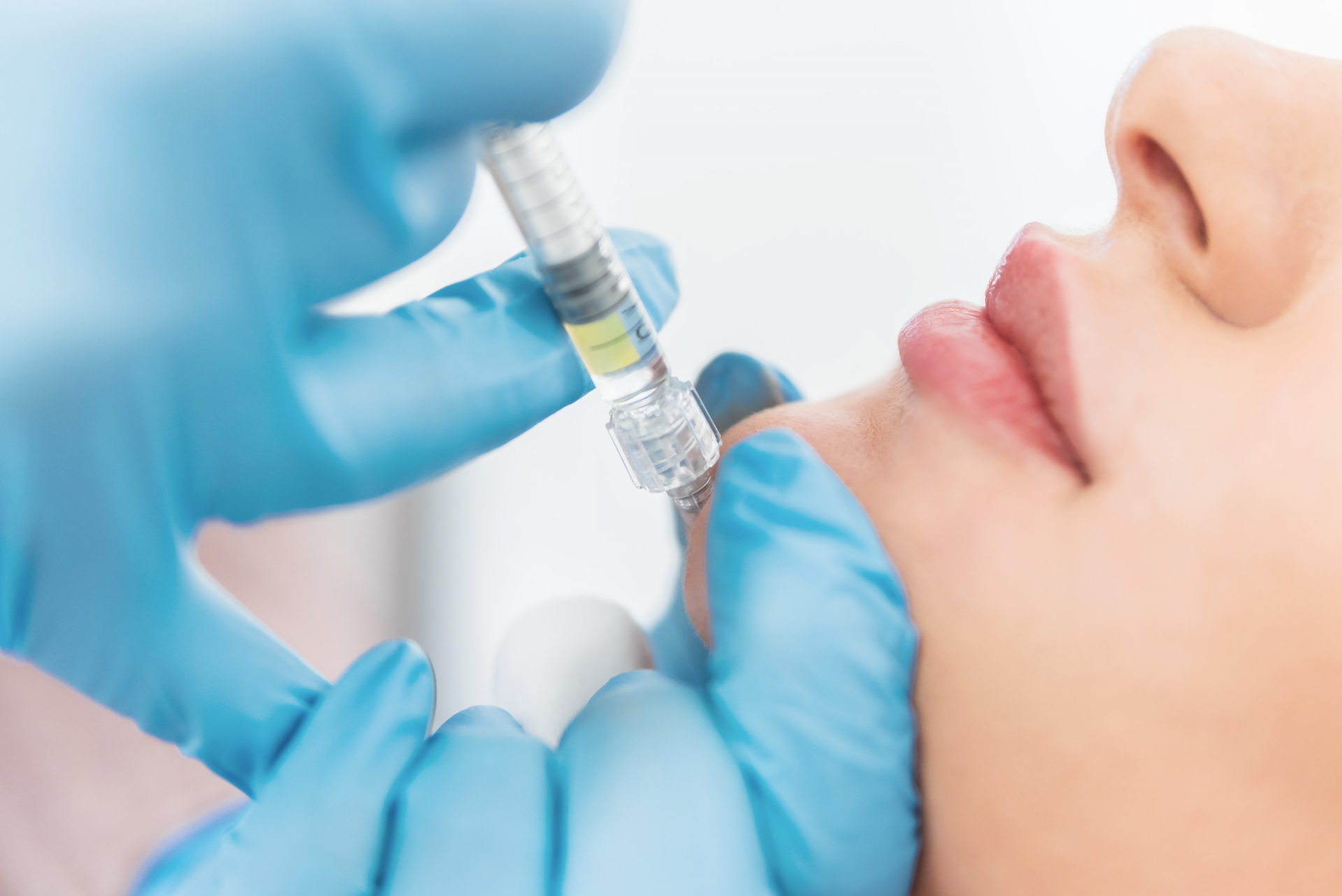 Young woman having ching hyaluronic fillers done.