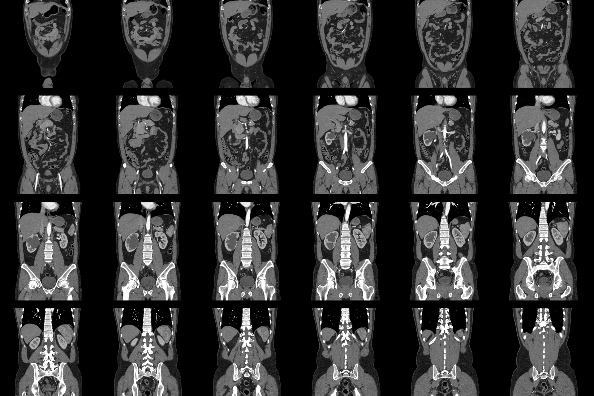 CT2